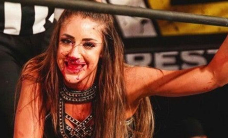 WWE亚当·科尔女友遭遇严重伤病，或长期缺席比赛！