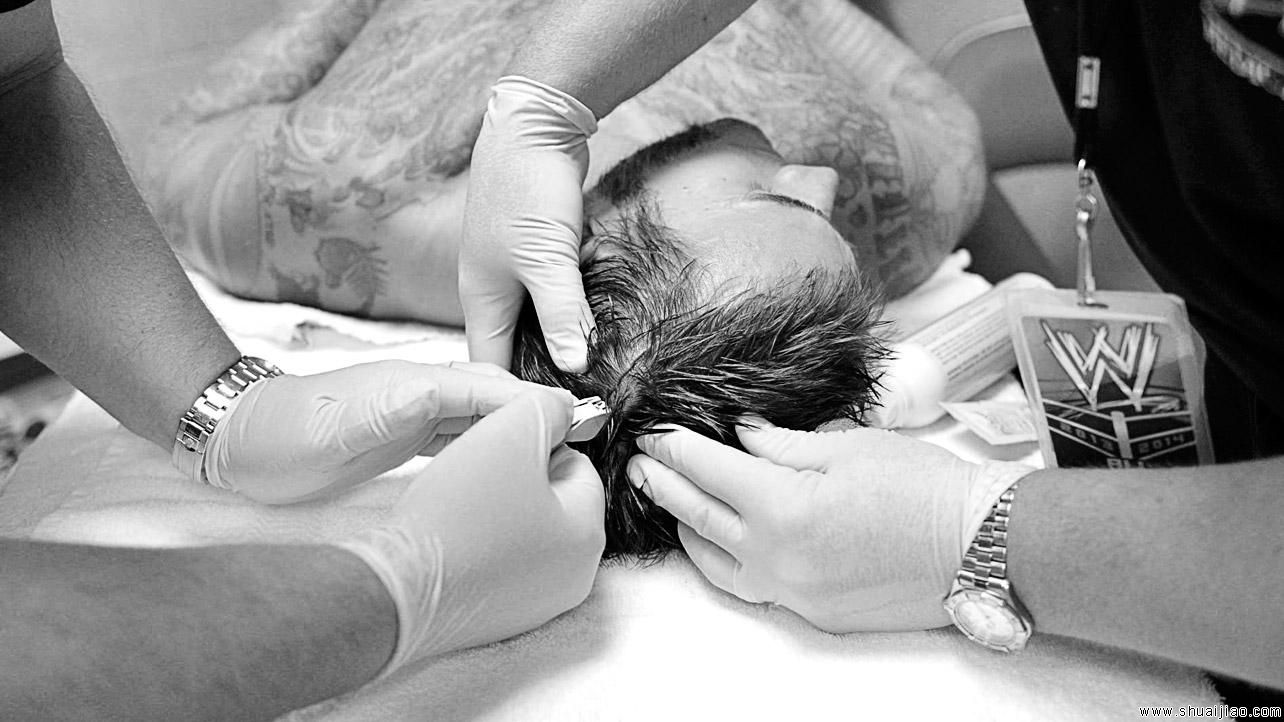 CM朋克、RVD后台接受医治《合约阶梯大赛2013》