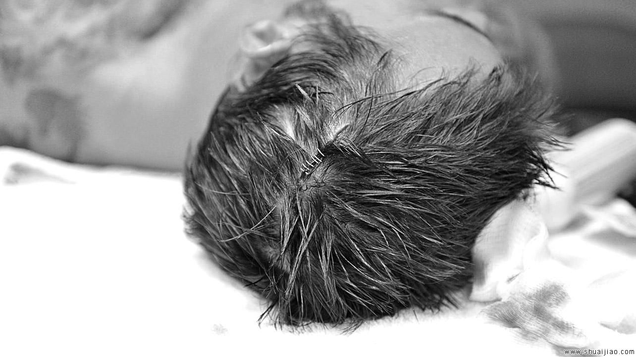 CM朋克、RVD后台接受医治《合约阶梯大赛2013》