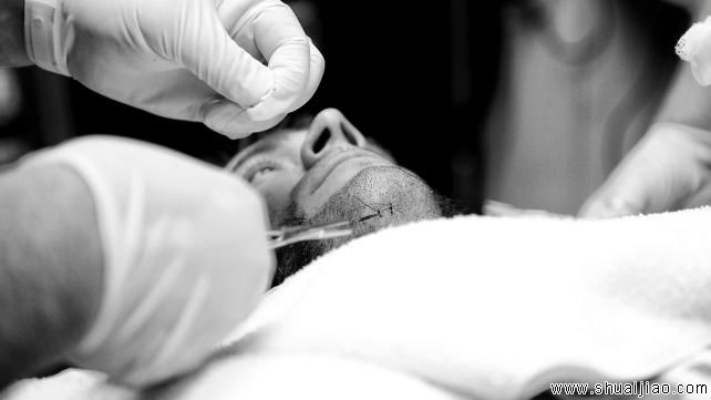 CM朋克赛后接受缝针