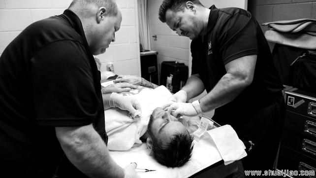 CM朋克赛后接受缝针