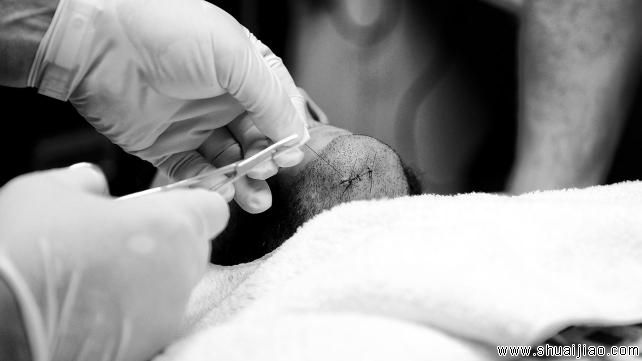 CM朋克赛后接受缝针