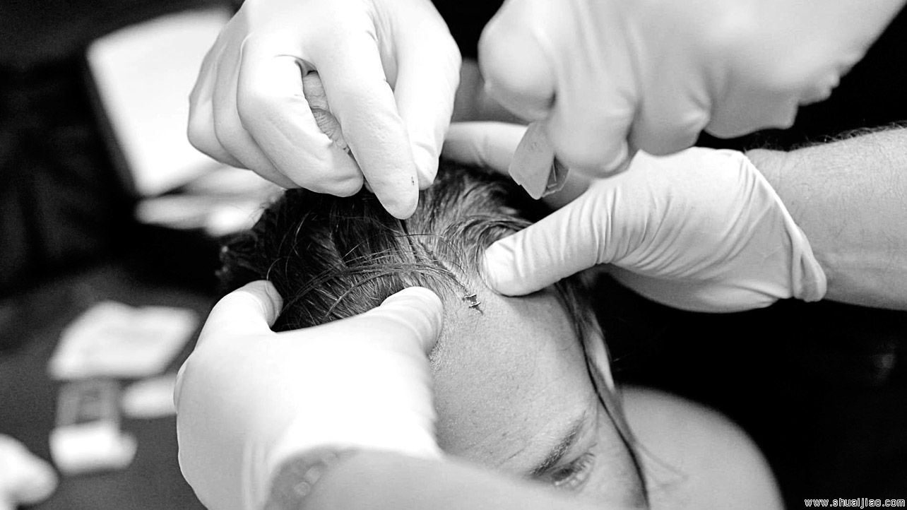 WWE摔角手们的战斗伤痕