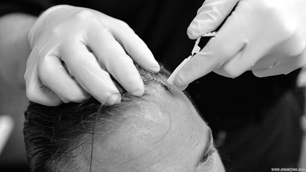 WWE摔角手们的战斗伤痕