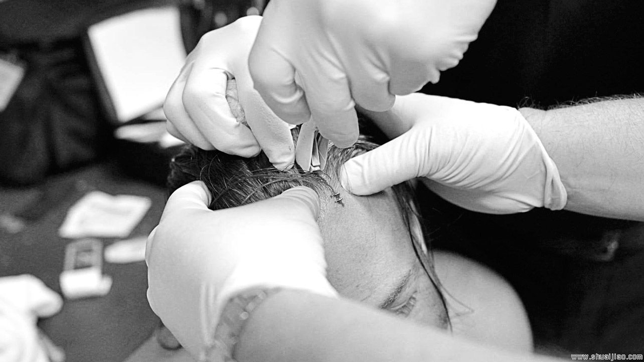 WWE摔角手们的战斗伤痕