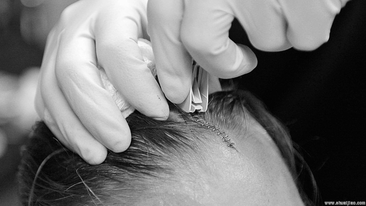 WWE摔角手们的战斗伤痕