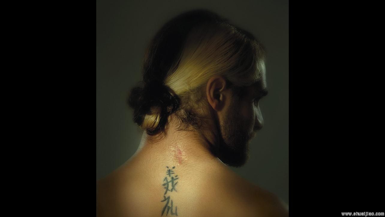 WWE摔角巨星们鲜为人知的伤疤