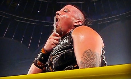 前WWE选手萨米·卡罗汉晒恶战伤情照，画面血腥慎点！