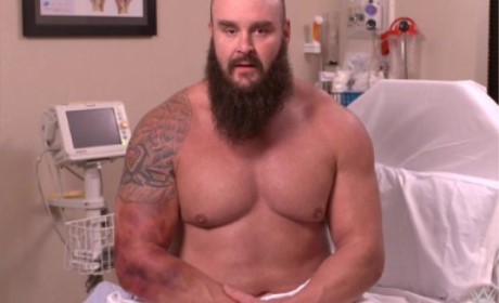 WWE黑羊今日接受手术，伤势远比预期的要重！