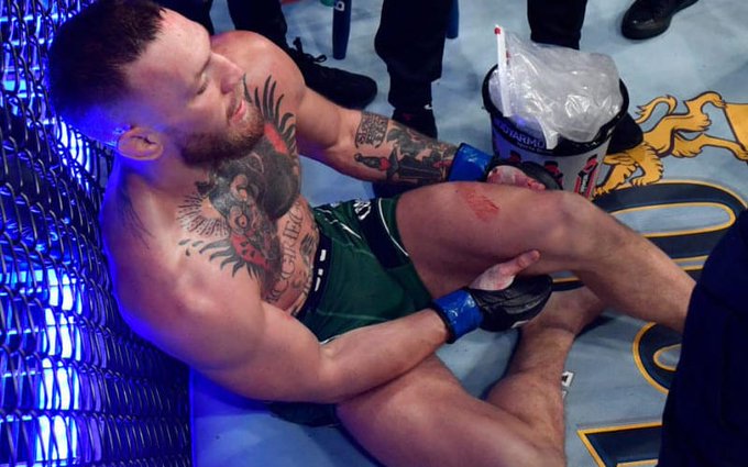 UFC嘴炮康纳已完成手术，时长长达3个多小时！