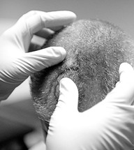 布洛克·莱斯纳头部受伤缝针图片《地狱牢笼大赛2015》